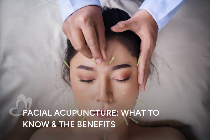 TCM Facial Acupuncture Thumbnail.png