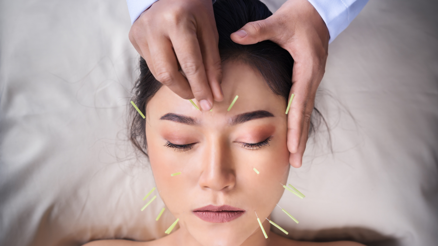 TCM Facial Acupuncture Hero.png