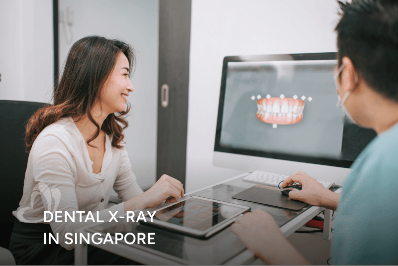 Dental_X-ray_in_Singapore_Thumbnail_400x267.png