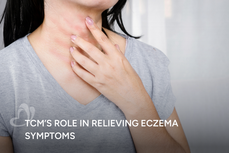 TCM Role in Relieving Eczema Thumbnail.png