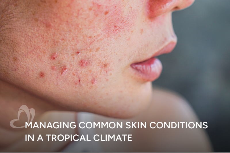 Managing Common Skin Conditions in a Tropical Climate_Thumbnail_400x267.png