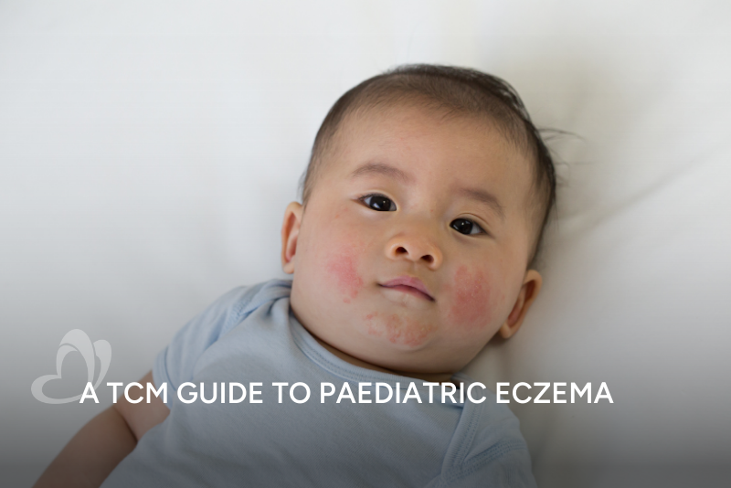 TCM Guide to Paediatric Eczema Thumbnail.png