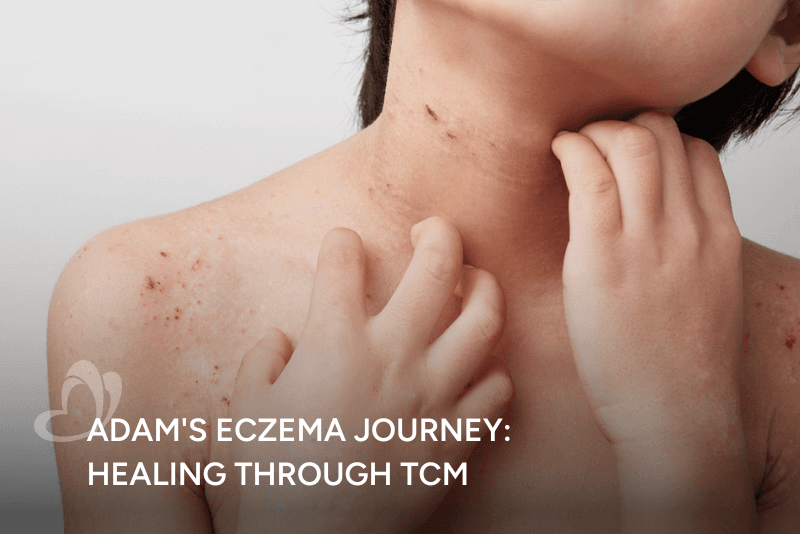 Adam eczema journey Thumbnail.png