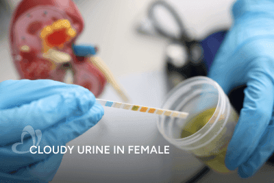 Cloudy urine-Thumbnail.png