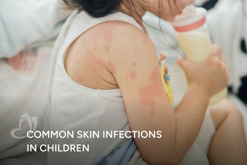 Common Skin Infections in Children_Thumbnail_400x267.png