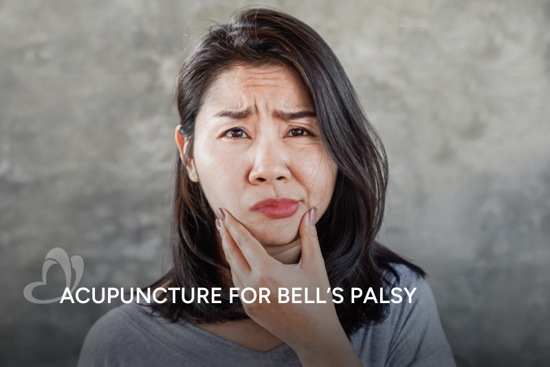 TCM Acupuncture for Bell's Palsy Thumbnail.png