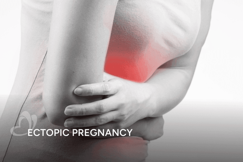 Ectopic Pregnancy_400x267.png